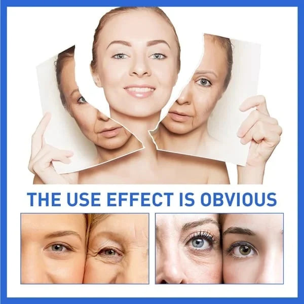 🌱Last Day Promotion 70% OFF🔥-Botox Facial Essence💖💖