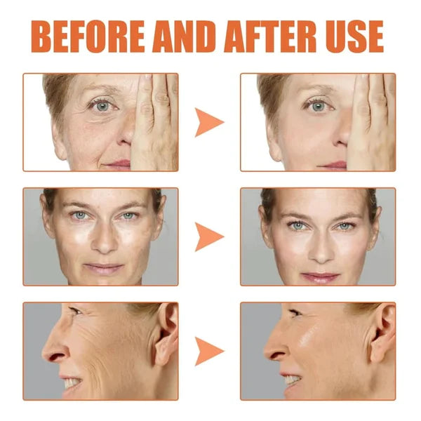 🌱Last Day Promotion 70% OFF🔥-Botox Facial Essence💖💖