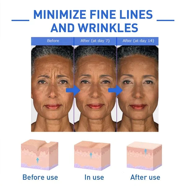 🌱Last Day Promotion 70% OFF🔥-Botox Facial Essence💖💖
