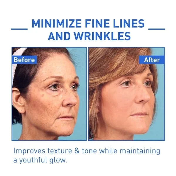 🌱Last Day Promotion 70% OFF🔥-Botox Facial Essence💖💖