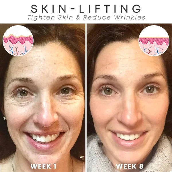 🌱Last Day Promotion 70% OFF🔥-Botox Facial Essence💖💖