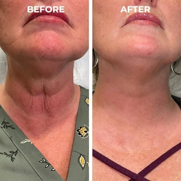 🌱Last Day Promotion 70% OFF🔥-Botox Facial Essence💖💖