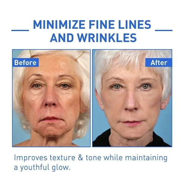 🌱Last Day Promotion 70% OFF🔥-Botox Facial Essence💖💖