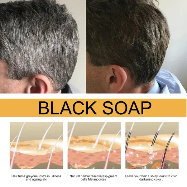 🔥 BLACK SOAP(Newly upgraded new packaging)