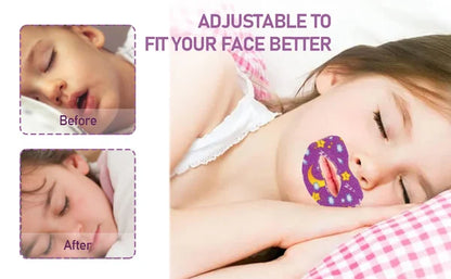 Anti-Snoring Patches