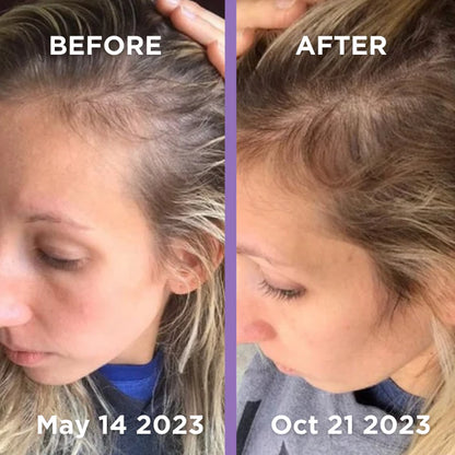 hair growth comb