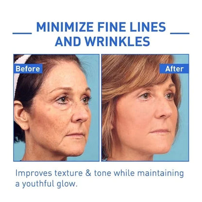 🌱Last Day Promotion 70% OFF🔥-Botox Facial Essence💖💖