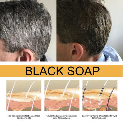 🔥 BLACK SOAP（Newly upgraded new packaging）